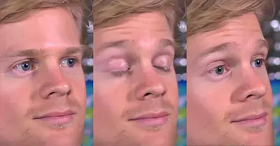 Blinking white guy meme template