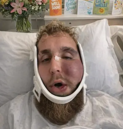 Jake Paul face beaten up meme template
