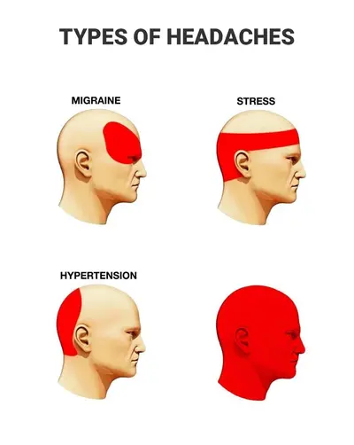 Types of headaches diagram meme template