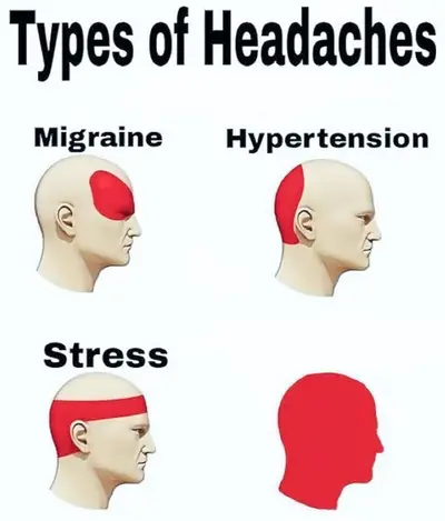 Types of Headaches meme template