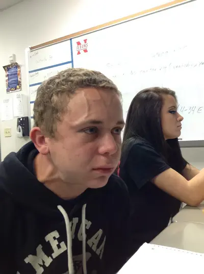 Vein forehead guy meme template
